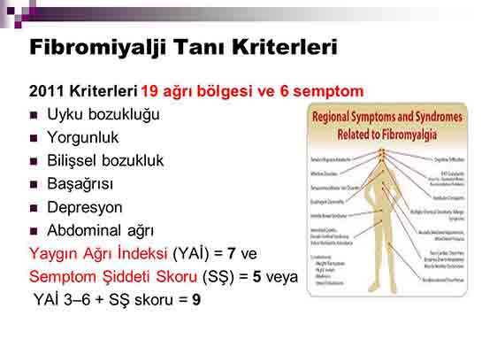 Fibromiyalji Tan Kriterleri
